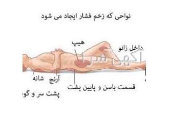 پانسمان تخصصی زخم پای دیابتی وزخم بستر در منزل انجام تخصصی پانسمان زخم