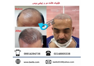کلینیک زیبایی بریس