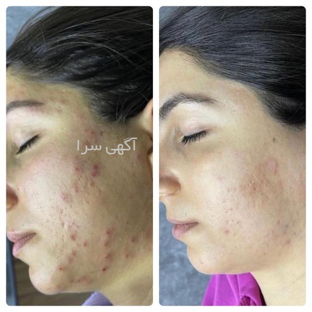 ماسک صورت ورقه ای دیجی کالا