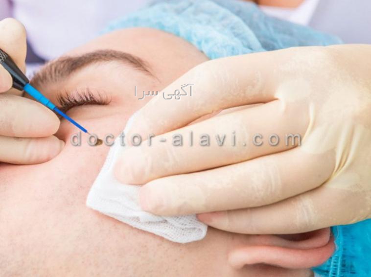 پیرسینگ دیجی کالا