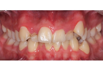 متخصص ارتودنسی و ناهنجاری های فک و صورت دندانپزشک و متخصص در زمینه ردیف