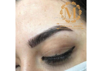 مدل برای خدمات فیبروز به مدت محدود مدل برای انجام خدمات فیبروز