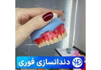 ساخت دندان مصنوعی