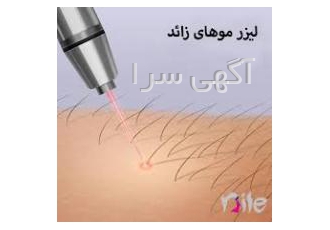 لیزر موهای زائد لیزر موهای زائد توسط اپراتور حرفه ای لیزر خانم ها