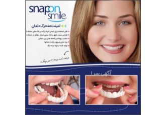 لمینت متحرک دندان snap on smile توضیحات لمینت متحرک دندان Snap On Smile