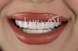 چسب لیفت صورت کره ای دیجی کالا