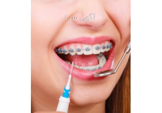 بهترین متخصص ارتودنسی دندان    کلینیک تخصصی ارتودنسی