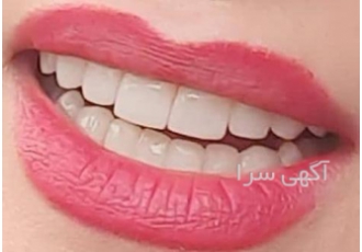 لابراتوار پروتز دندان پرسیژن