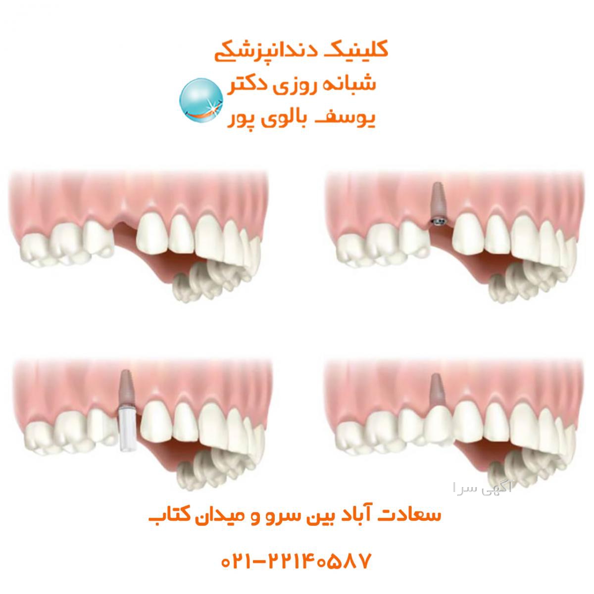 دکتر حامد رحیمی متخصص جراح ایمپلنت و لثه