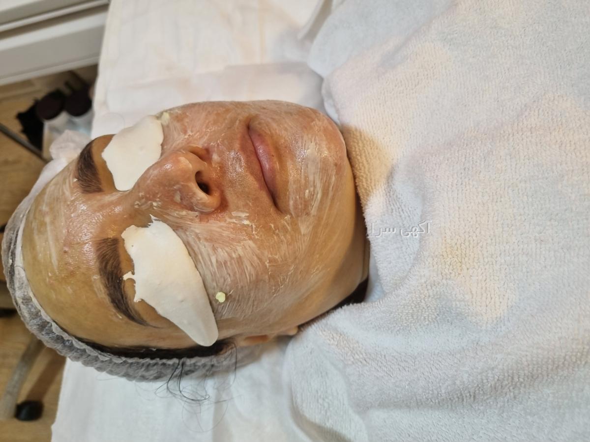 سرم رتینول اوردینری دیجی کالا