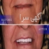 ایمپلنت دندان با بیمه پارسیان : مناسب ترین تعرفه در تهران ایمپلنت