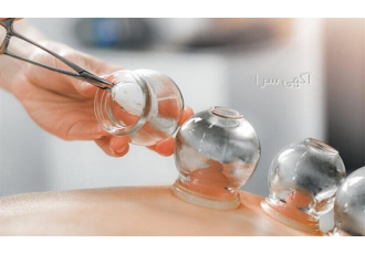 دوره آموزش زالو درمانی حجامت و بادکش گام به گام در تهران دوره حجامت