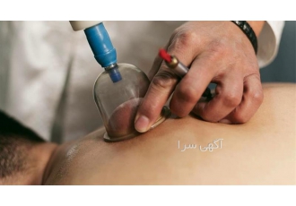برگزاری تخصصی ترین دوره آموزش طب سنتی در بیرجند آموزش حجامت بادکش و فصد