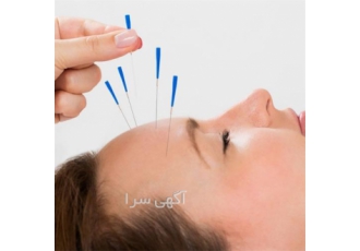 آموزش طب سنتی با مدرک معتبر بادکش درمانی در اراک آموزش طب سنتی