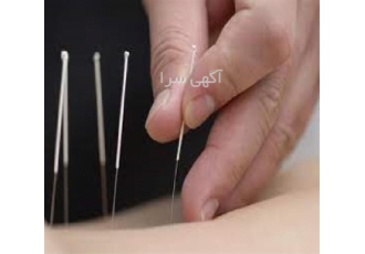 دوره طب سوزنی آموزش حجامت با مدرک در شیراز آموزش صفر تا صد دوره طب