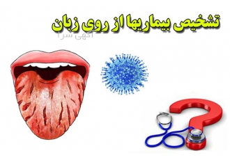 دوره آموزش مزاج شناسی و زبان شناسی و تغذیه سالم