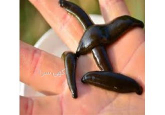 دوره کمک های اولیه آموزش زالو درمانی در اهواز دوره کمک های اولیه