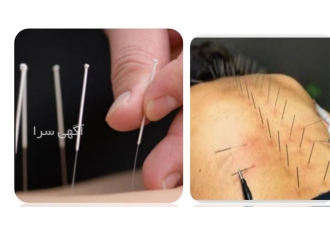 آموزش طب سوزنی با مدرک آموزش روی مدل زنده در مشهد برگزاری تخصص ترین