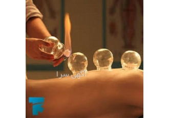 آموزش حجامت ، زالو درمانی و بادکش