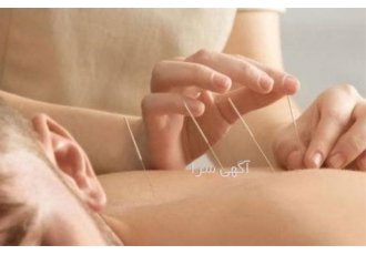 آموزش طب سوزنی ، دوره های آموزشی طب سنتی کاربردی