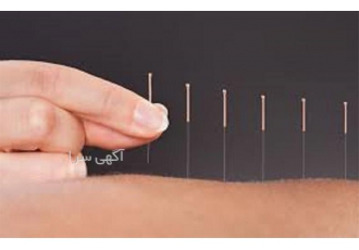 آموزش تخصصی طب سوزنی لاغری
