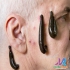آموزش ماساژ تزریقات طب سوزنی زالو درمانی در اصفهان بهترین و تخصصی