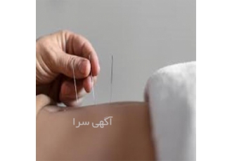 دوره آموزش طب فشاری و طب سوزنی