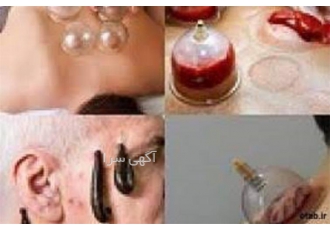 آموزش حجامت تخصصی ، به صورت کاربردی
