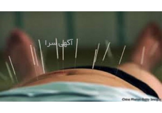 دوره آموزش طب سوزنی با مدرک معتبر در تهران دوره آموزش طب سوزنی به صورت