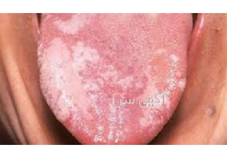 دوره آموزش مزاج شناسی و زبان شناسی با اعطای مدرک