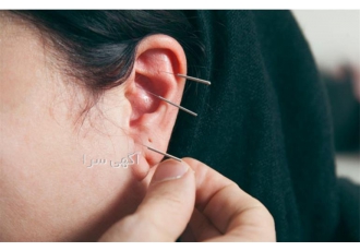 دوره آموزشی طب سنتی ، دوره حجامت