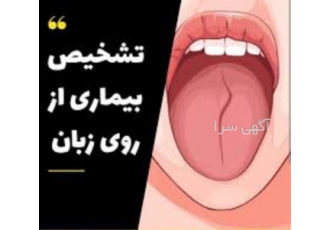 دوره‌های جامع طب سنتی و حجامت با مدرک فنی حرفه‌ای معتبر در ارومیه اگر