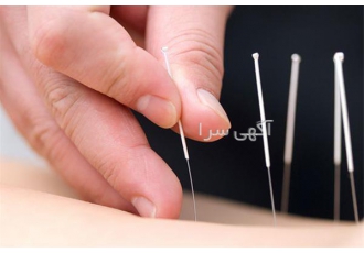 آموزش طب سوزنی مقدماتی در تهران آموزش طب سوزنی مقدماتی آموزش صفر تا صد