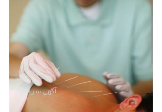 آموزش مبتدی تا پیشرفته طب سوزنی با مدرک