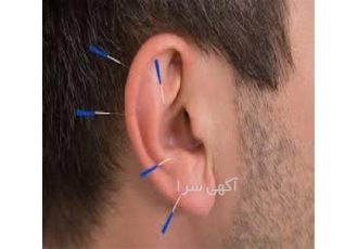 دوره‌های پیشرفته آموزش طب سنتی و سوزنی با مدرک بین‌المللی در یزد آیا
