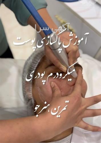 ماسک صورت برای جوش و لک دیجی کالا