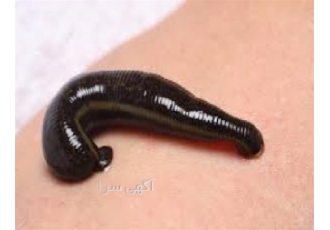 کلاس آموزش تزریقات و طب سنتی زالو درمانی