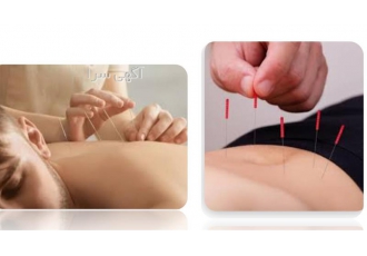 دوره‌های جامع طب سنتی و سوزنی با مدرک معتبر و اساتید حرفه‌ای