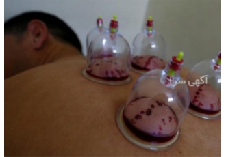 آموزش طب سنتی تخصصی جهت ورود به بازار کار