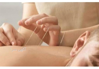دوره طب سوزنی با مدرک بین المللی معتبر در تهران دوره طب سوزنی با مدرک