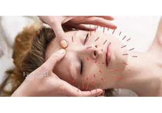 دوره آموزشی طب سوزنی با مدرک معتبر