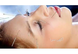آموزش طب سوزنی و طب سنتی همراه با اعطای مدرک معتبر