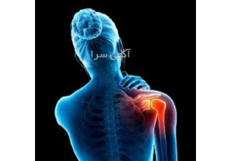 دوره آموزش بادکش درمانی به صورت حضوری آنلاین در تهران دوره آموزش
