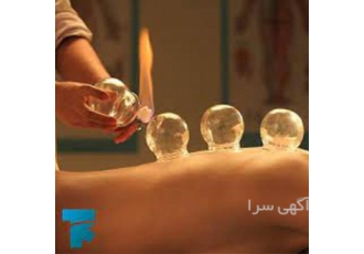 آموزش بادکش گرم و سرد به صورت تخصصی در تهران آموزش بادکش گرم و سرد