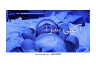 دستگاه زردی نوزاد و شیردوش برقی