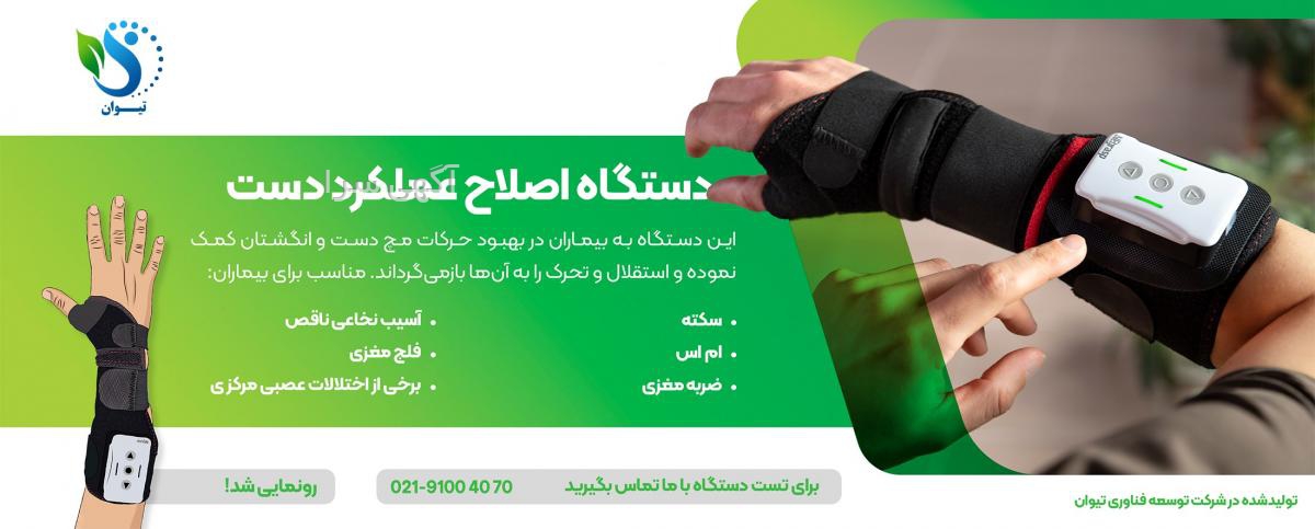 متخصص خواب رفتن دست و پا