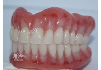 دندان مصنوعی ارزان