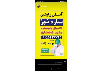 اسان رابیتس ستاره شهر رابیتس بدون جوش zwnj کاری مقاومت و استحکام بیشتر