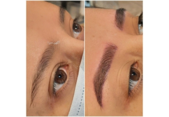 میکروبلیدینگ تخفیف ویژه 50 درصدی فیبروز بلدبروز فقط از 5 اسفند تا 10