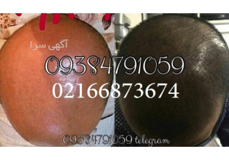 پکیج رویش مو دکتر نوروزیان فروش حضوری و انلاین پکیج رویش مو دکتر